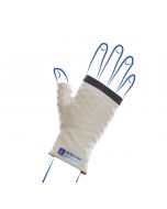 Mobiderm nighttime compression gauntlet for hand lymphedema